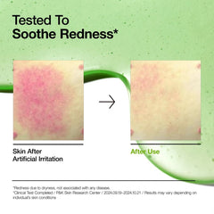 ANUA - Azelaic Acid 10% Hyaluron Redness Soothing Serum
